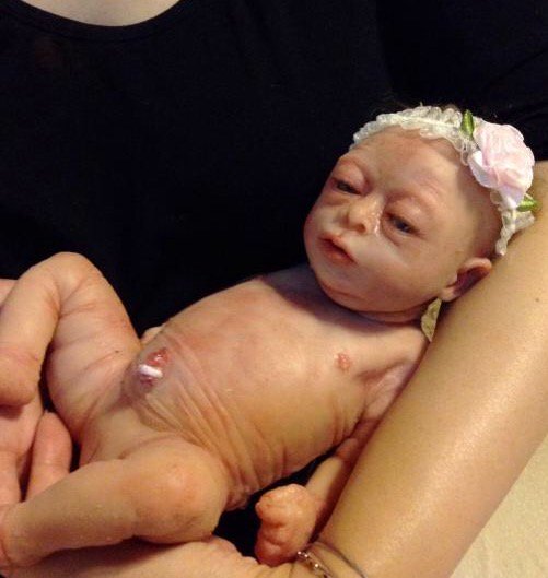 リボーンドール フルシリコン へその緒の付いた新生児-