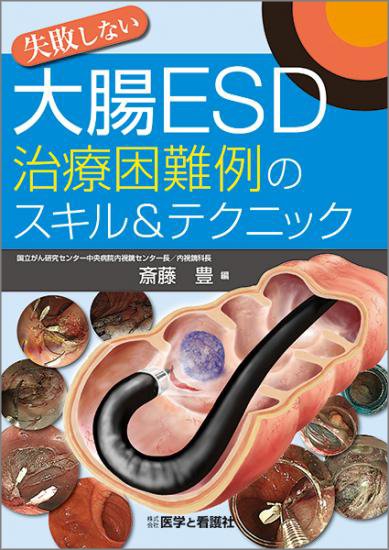 送料無料】本/イラストで見る食道・大腸EMRと胃ESD 安全な内視鏡治療の