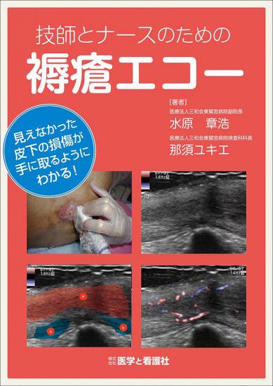 技師とナースのための褥瘡エコー - 医学と看護社